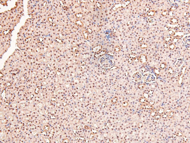 Phospho-RARA/RARB (Ser96) Antibody in Immunohistochemistry (Paraffin) (IHC (P))