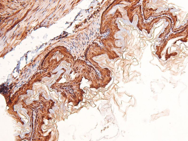 Phospho-LRP1 (Ser4520) Antibody in Immunohistochemistry (Paraffin) (IHC (P))