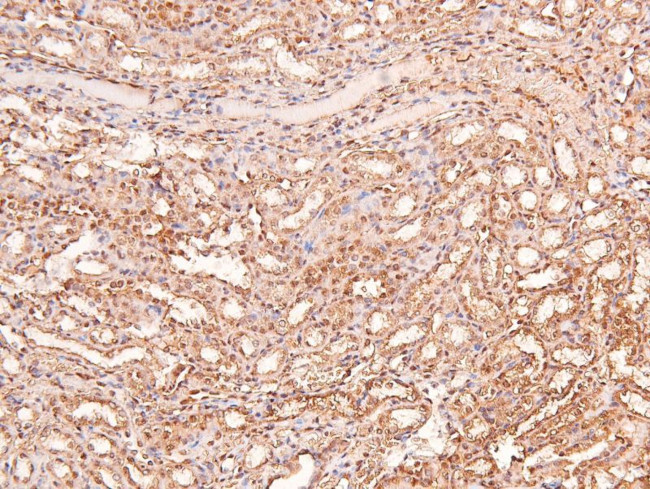 Phospho-LRP1 (Ser4520) Antibody in Immunohistochemistry (Paraffin) (IHC (P))