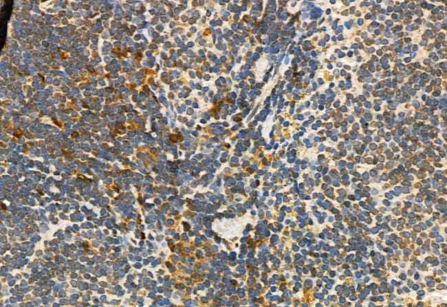 Phospho-ERK1/ERK2 (Thr202, Tyr204, Thr185, Tyr187) Antibody in Immunohistochemistry (Paraffin) (IHC (P))