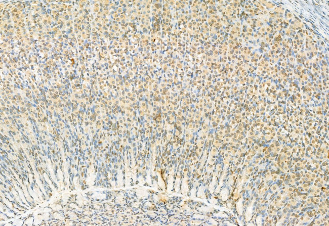 Phospho-ERK1/ERK2 (Thr202, Tyr204, Thr185, Tyr187) Antibody in Immunohistochemistry (Paraffin) (IHC (P))