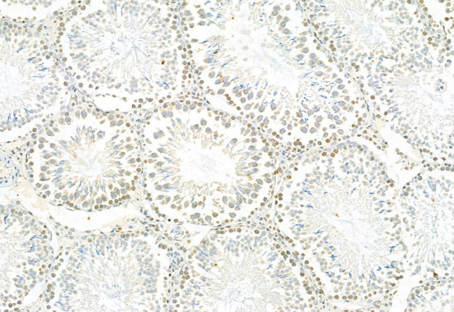 Phospho-ERK1/ERK2 (Thr202, Tyr204, Thr185, Tyr187) Antibody in Immunohistochemistry (Paraffin) (IHC (P))