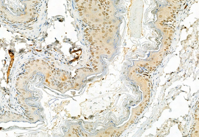 Phospho-ERK1/ERK2 (Thr202, Tyr204, Thr185, Tyr187) Antibody in Immunohistochemistry (Paraffin) (IHC (P))