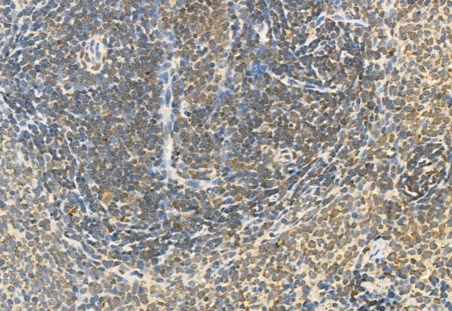 Phospho-ERK1/ERK2 (Thr202, Tyr204, Thr185, Tyr187) Antibody in Immunohistochemistry (Paraffin) (IHC (P))