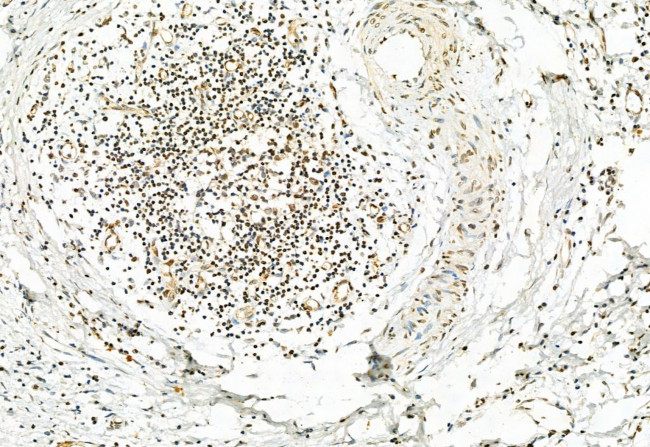 Phospho-ERK1/ERK2 (Thr202, Tyr204, Thr185, Tyr187) Antibody in Immunohistochemistry (Paraffin) (IHC (P))