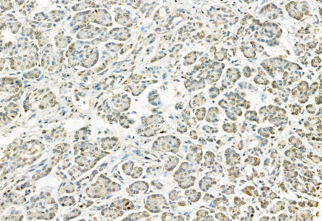 Phospho-ERK1/ERK2 (Thr202, Tyr204, Thr185, Tyr187) Antibody in Immunohistochemistry (Paraffin) (IHC (P))