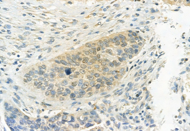 Phospho-ERK1/ERK2 (Thr202, Tyr204, Thr185, Tyr187) Antibody in Immunohistochemistry (Paraffin) (IHC (P))