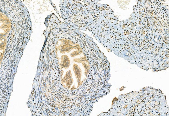 Phospho-ERK1/ERK2 (Thr202, Tyr204, Thr185, Tyr187) Antibody in Immunohistochemistry (Paraffin) (IHC (P))