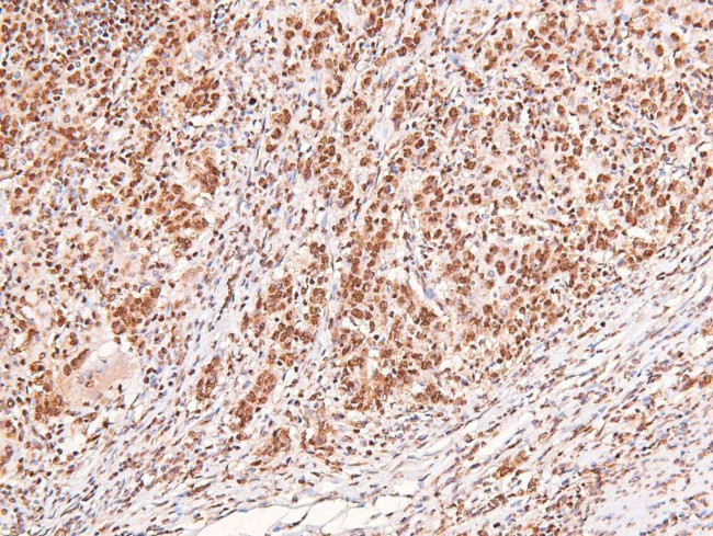 Phospho-ERK1/ERK2 (Thr202, Tyr204, Thr185, Tyr187) Antibody in Immunohistochemistry (Paraffin) (IHC (P))