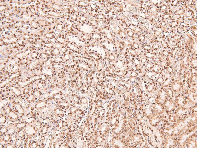 Phospho-ERK1/ERK2 (Thr202, Tyr204, Thr185, Tyr187) Antibody in Immunohistochemistry (Paraffin) (IHC (P))