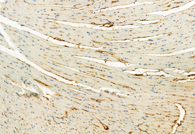 Phospho-FGFR Pan (Tyr653, Tyr654) Antibody in Immunohistochemistry (Paraffin) (IHC (P))