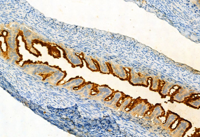 Phospho-FGFR Pan (Tyr653, Tyr654) Antibody in Immunohistochemistry (Paraffin) (IHC (P))