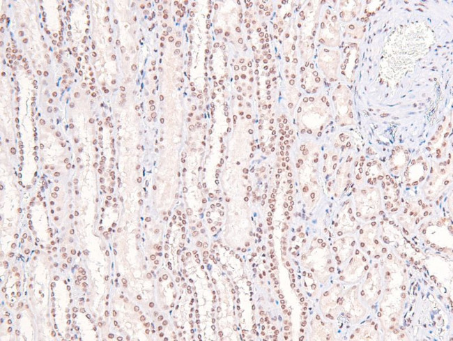 Phospho-FGFR Pan (Tyr653, Tyr654) Antibody in Immunohistochemistry (Paraffin) (IHC (P))