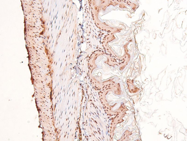 Phospho-FGFR Pan (Tyr653, Tyr654) Antibody in Immunohistochemistry (Paraffin) (IHC (P))