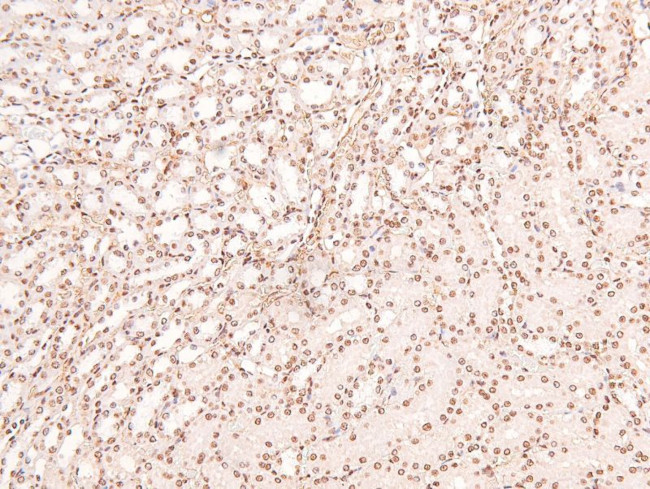 Phospho-FGFR Pan (Tyr653, Tyr654) Antibody in Immunohistochemistry (Paraffin) (IHC (P))