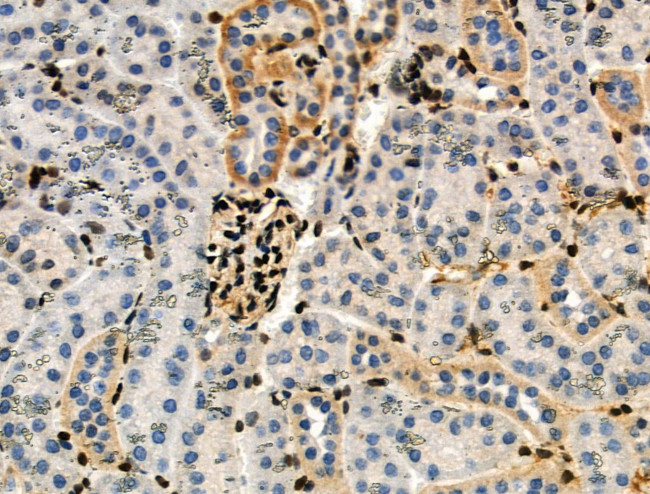 Phospho-RXRA (Ser260) Antibody in Immunohistochemistry (Paraffin) (IHC (P))