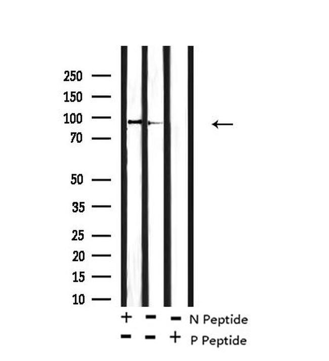 Phospho-alpha Dystroglycan (Tyr892) Antibody in Western Blot (WB)