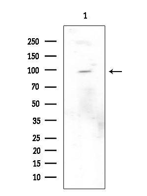 Phospho-Leptin Receptor (Tyr986) Antibody in Western Blot (WB)