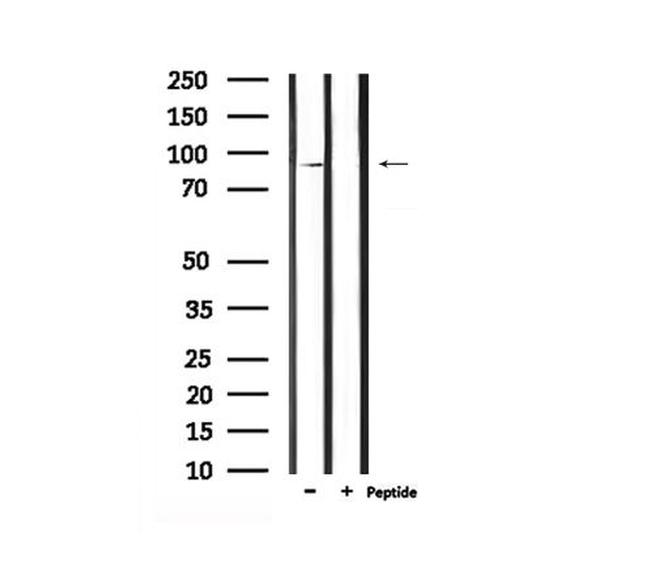 Phospho-Leptin Receptor (Tyr986) Antibody in Western Blot (WB)