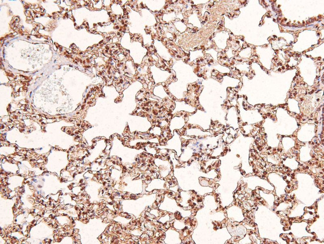 Phospho-EphB1/EphB3/EphB4 (Tyr778, Tyr792, Tyr774) Antibody in Immunohistochemistry (Paraffin) (IHC (P))