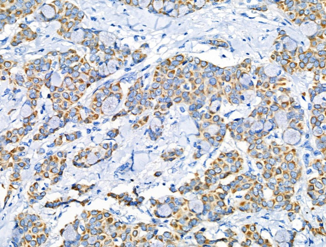 Phospho-Leptin Receptor (Tyr1141) Antibody in Immunohistochemistry (Paraffin) (IHC (P))