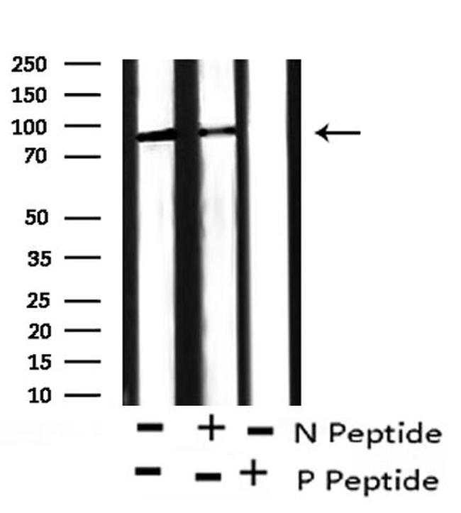 Phospho-Leptin Receptor (Tyr1141) Antibody in Western Blot (WB)