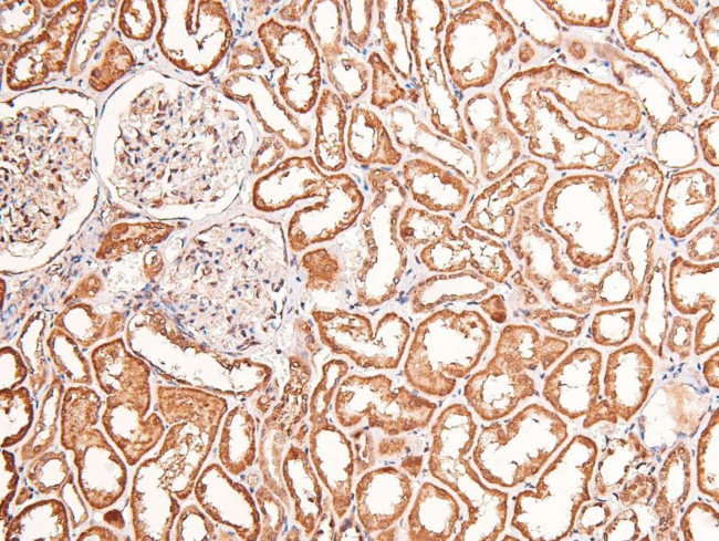 Phospho-FGFR1/FGFR2 (Tyr730, Tyr733) Antibody in Immunohistochemistry (Paraffin) (IHC (P))