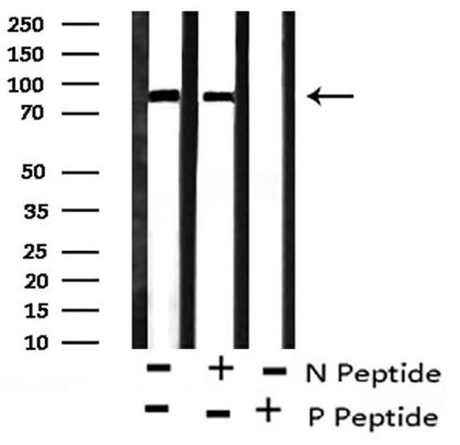 Phospho-FGFR1/FGFR2 (Tyr730, Tyr733) Antibody in Western Blot (WB)