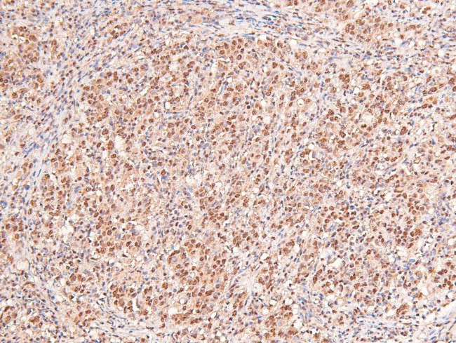 Phospho-IFNAR1 (Ser535) Antibody in Immunohistochemistry (Paraffin) (IHC (P))