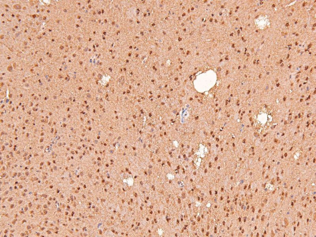 Phospho-IFNAR1 (Ser535) Antibody in Immunohistochemistry (Paraffin) (IHC (P))