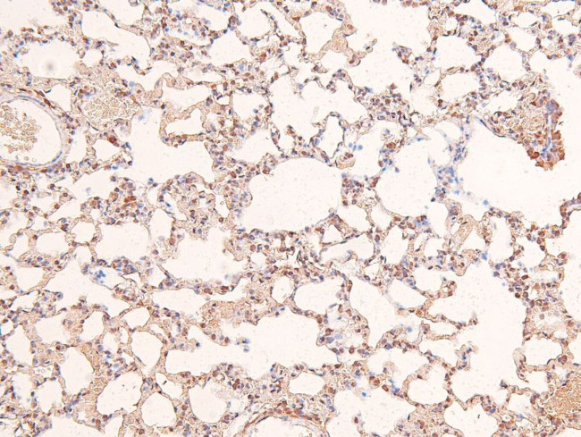 Phospho-IFNAR1 (Ser535) Antibody in Immunohistochemistry (Paraffin) (IHC (P))