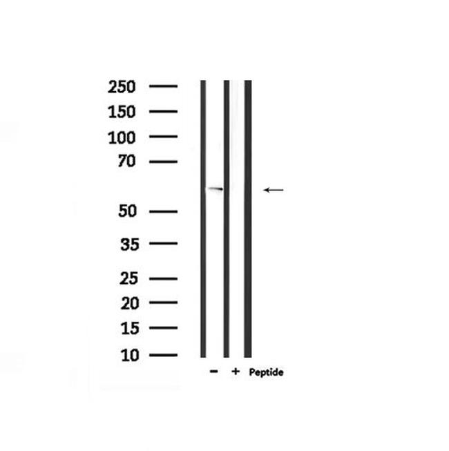 Phospho-IFNAR1 (Ser535) Antibody in Western Blot (WB)