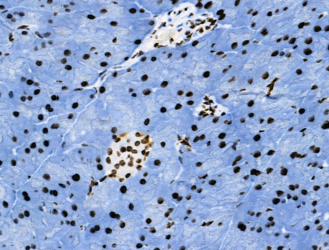 Phospho-Androgen Receptor (Tyr535) Antibody in Immunohistochemistry (Paraffin) (IHC (P))