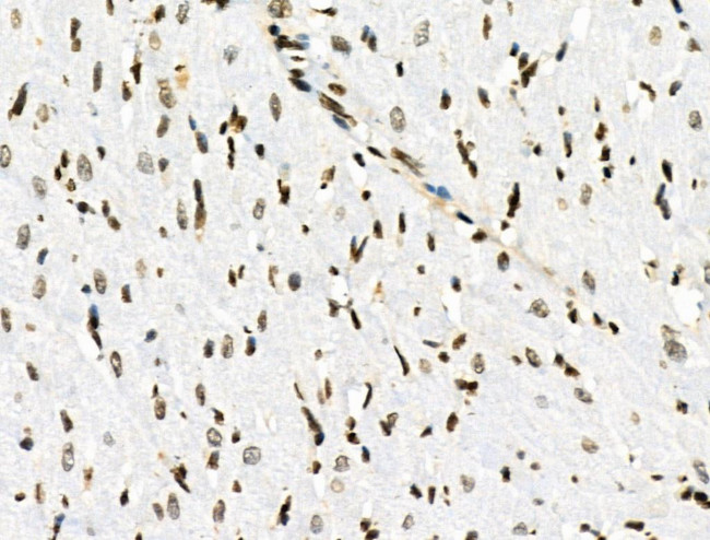 Phospho-Androgen Receptor (Tyr535) Antibody in Immunohistochemistry (Paraffin) (IHC (P))