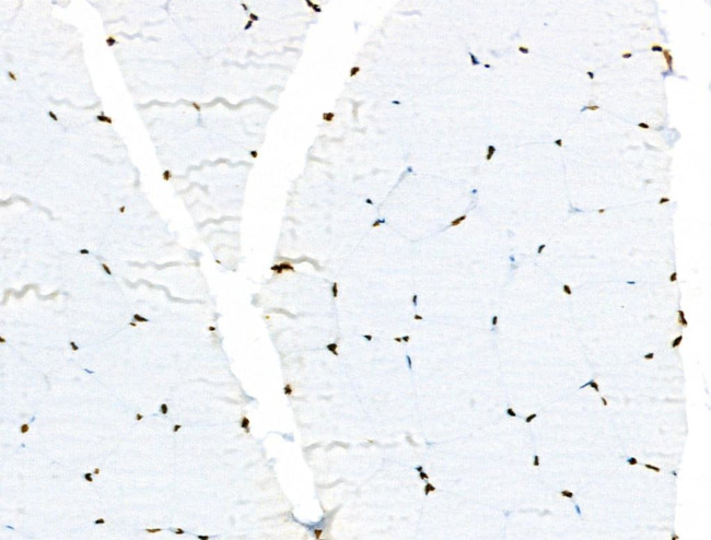 Phospho-Androgen Receptor (Tyr535) Antibody in Immunohistochemistry (Paraffin) (IHC (P))