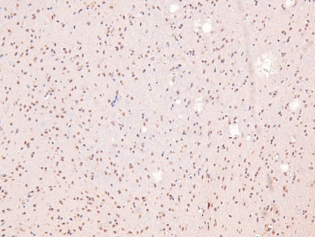 Phospho-Annexin A1 (Tyr21) Antibody in Immunohistochemistry (Paraffin) (IHC (P))