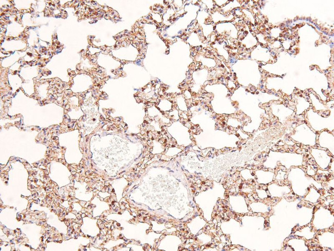 Phospho-Annexin A1 (Tyr21) Antibody in Immunohistochemistry (Paraffin) (IHC (P))