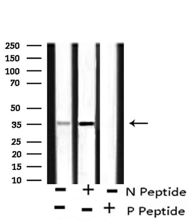 Phospho-Annexin A1 (Tyr21) Antibody in Western Blot (WB)