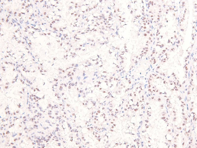 Phospho-Ataxin 3 (Ser256) Antibody in Immunohistochemistry (Paraffin) (IHC (P))