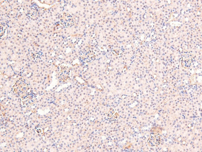 Phospho-Ataxin 3 (Ser256) Antibody in Immunohistochemistry (Paraffin) (IHC (P))