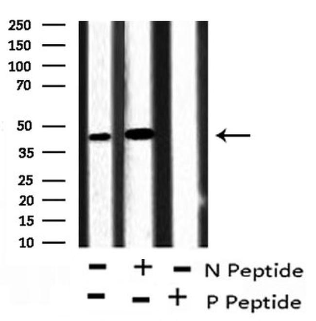 Phospho-Ataxin 3 (Ser256) Antibody in Western Blot (WB)