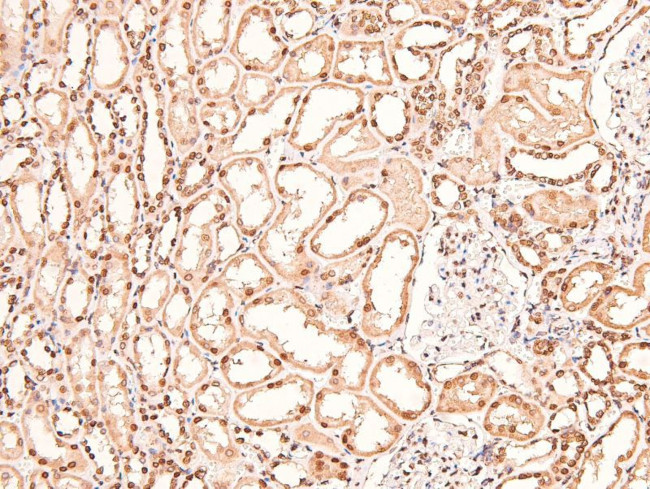 Phospho-BAG3 (Tyr457) Antibody in Immunohistochemistry (Paraffin) (IHC (P))