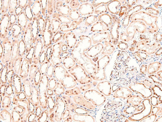 Phospho-BIK (Ser35) Antibody in Immunohistochemistry (Paraffin) (IHC (P))