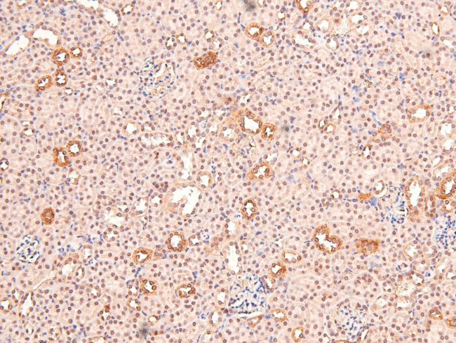 Phospho-BIK (Ser35) Antibody in Immunohistochemistry (Paraffin) (IHC (P))