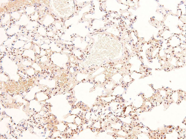 Phospho-BIK (Ser35) Antibody in Immunohistochemistry (Paraffin) (IHC (P))