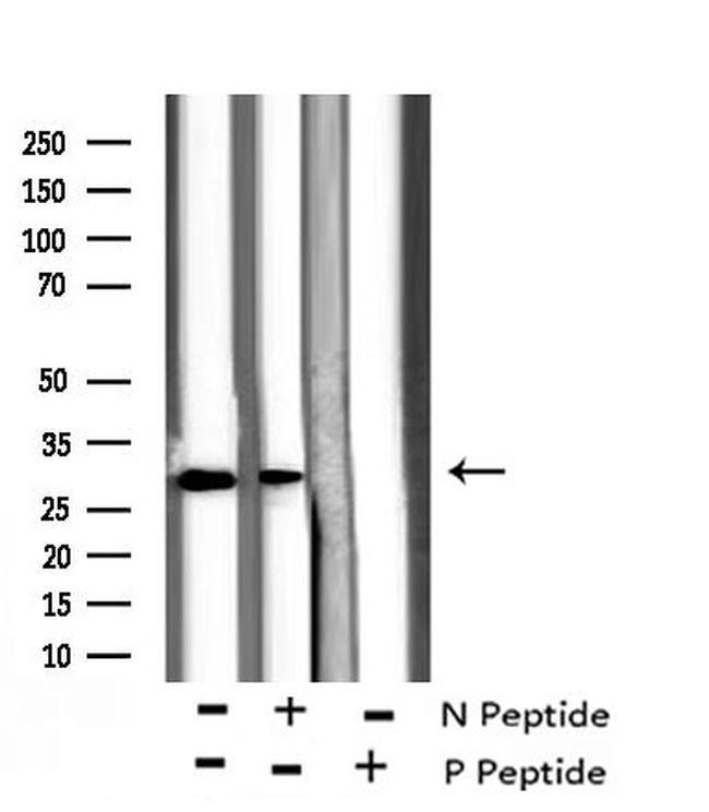 Phospho-BIK (Ser35) Antibody in Western Blot (WB)