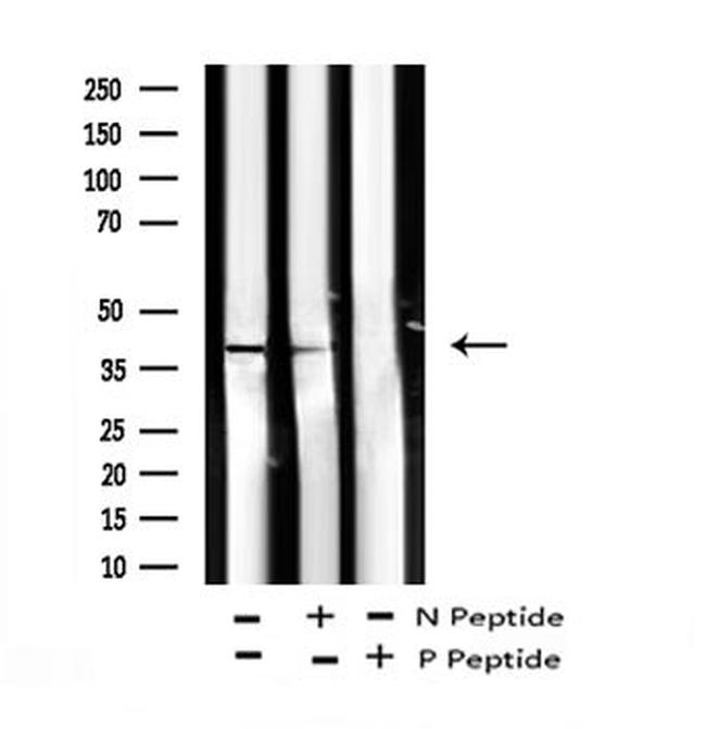 Phospho-CDX2 (Ser283) Antibody in Western Blot (WB)