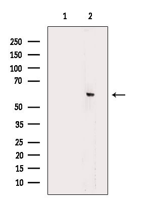 Phospho-DRP1 (Tyr504) Antibody in Western Blot (WB)