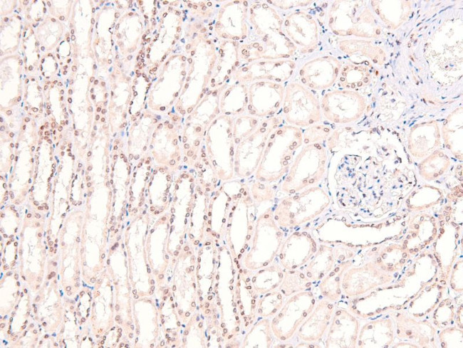 Phospho-DRP1 (Tyr504) Antibody in Immunohistochemistry (Paraffin) (IHC (P))