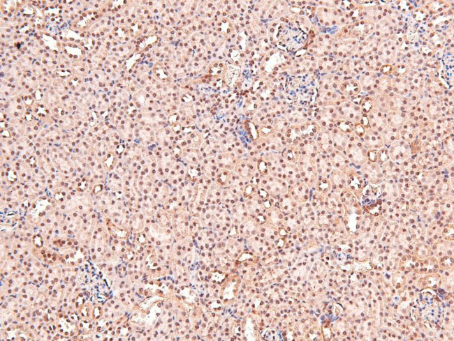 Phospho-DRP1 (Tyr504) Antibody in Immunohistochemistry (Paraffin) (IHC (P))